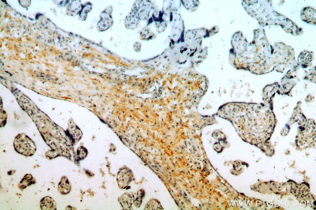 Immunohistochemistry (IHC) staining of human placenta tissue using SNX20 Polyclonal antibody (13180-1-AP)