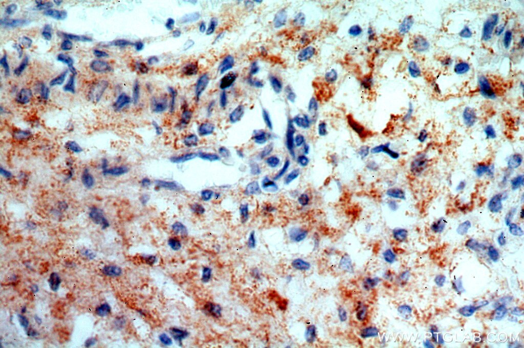 Immunohistochemistry (IHC) staining of human placenta tissue using SNX20 Polyclonal antibody (13180-1-AP)