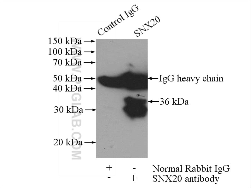 Immunoprecipitation (IP) experiment of COLO 320 cells using SNX20 Polyclonal antibody (13180-1-AP)