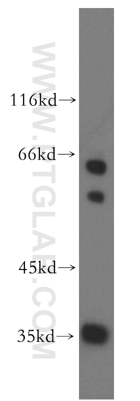 Western Blot (WB) analysis of COLO 320 cells using SNX20 Polyclonal antibody (13180-1-AP)
