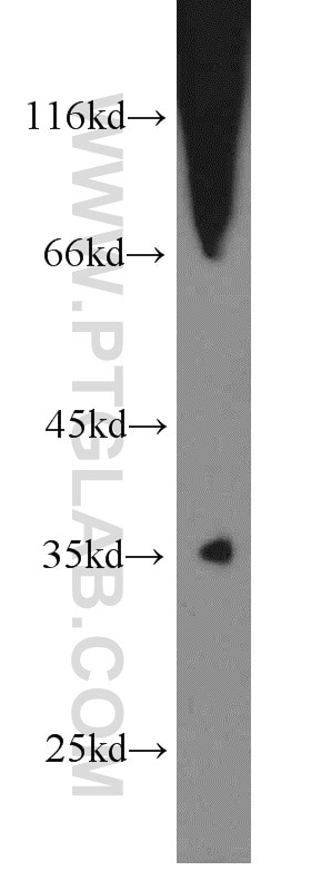 Western Blot (WB) analysis of mouse thymus tissue using SNX20 Polyclonal antibody (13180-1-AP)