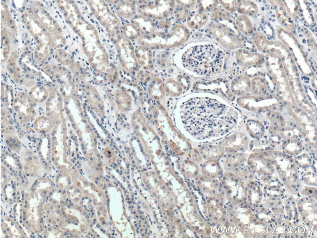 Immunohistochemistry (IHC) staining of human kidney tissue using SNX21 Polyclonal antibody (22193-1-AP)