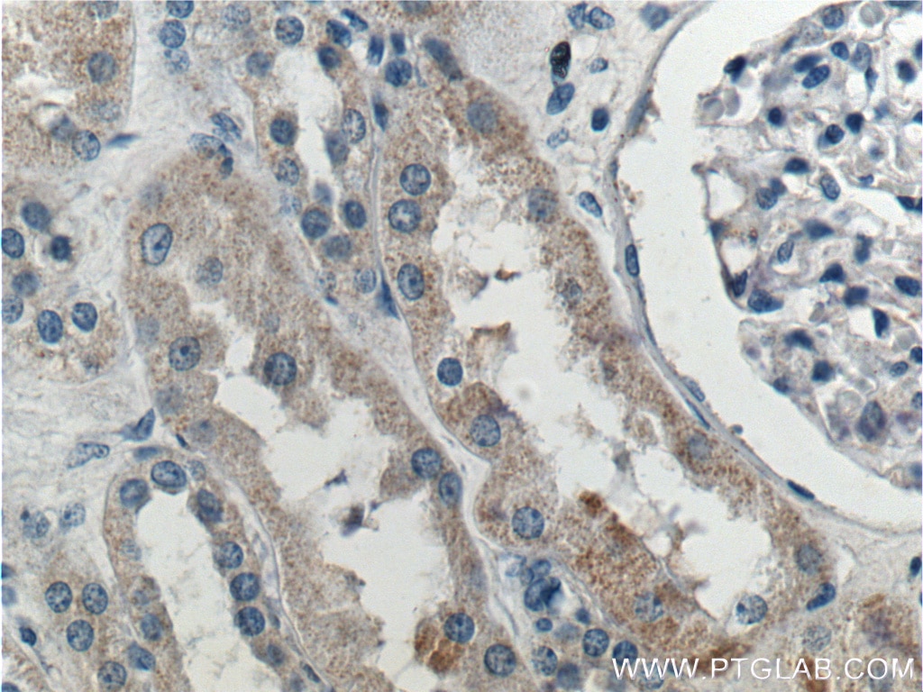 Immunohistochemistry (IHC) staining of human kidney tissue using SNX21 Polyclonal antibody (22193-1-AP)