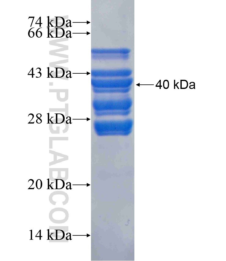 SNX21 fusion protein Ag16900 SDS-PAGE