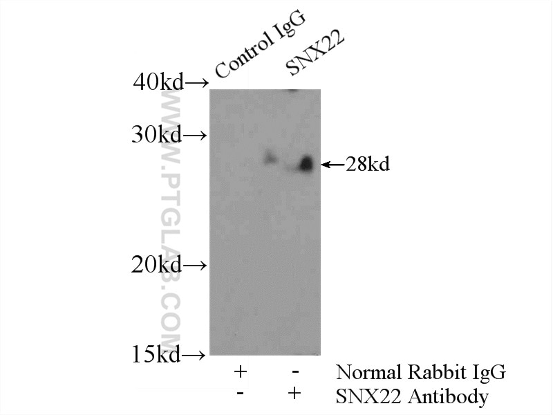 Immunoprecipitation (IP) experiment of mouse liver tissue using SNX22 Polyclonal antibody (13062-1-AP)