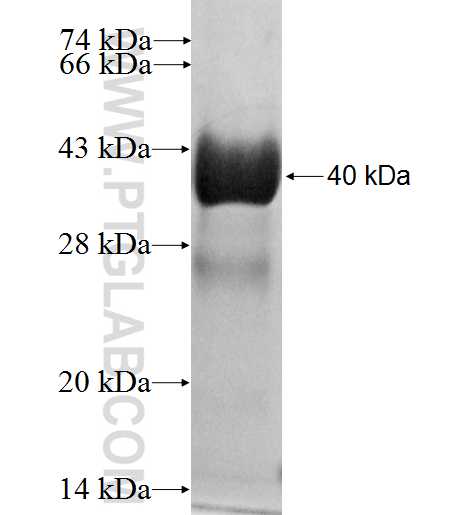 SNX22 fusion protein Ag3751 SDS-PAGE