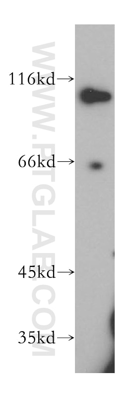 Western Blot (WB) analysis of Jurkat cells using SNX25 Polyclonal antibody (13294-1-AP)