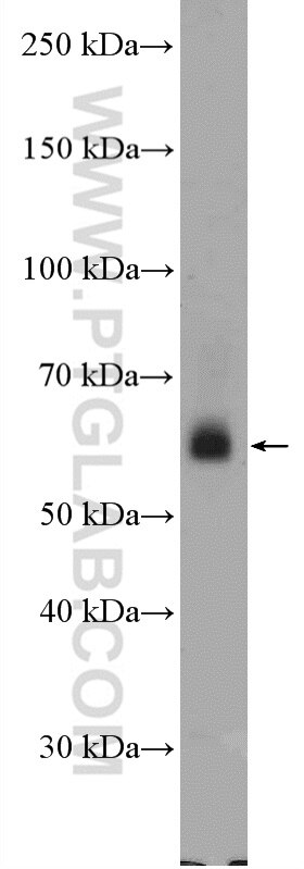 Western Blot (WB) analysis of mouse spleen tissue using SNX27 Polyclonal antibody (16329-1-AP)