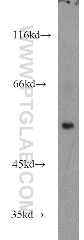 Western Blot (WB) analysis of Jurkat cells using SNX27 Polyclonal antibody (16329-1-AP)