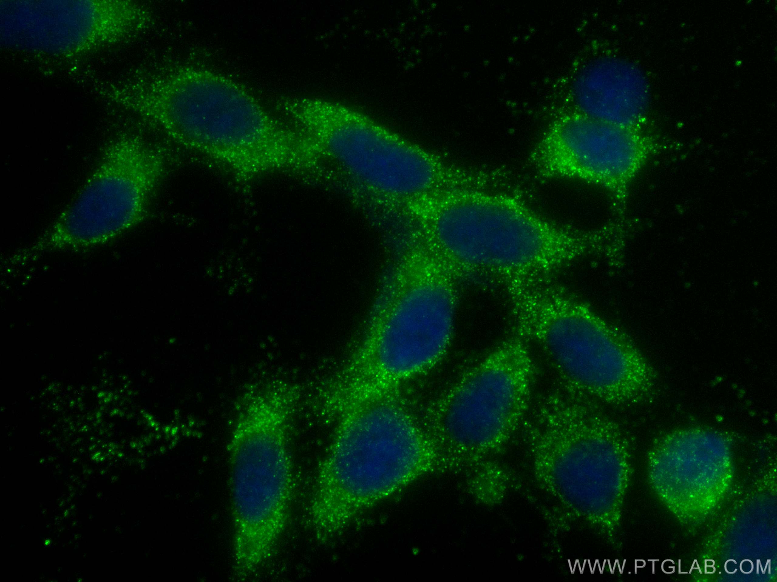 Immunofluorescence (IF) / fluorescent staining of HEK-293 cells using SNX27 Monoclonal antibody (68386-1-Ig)