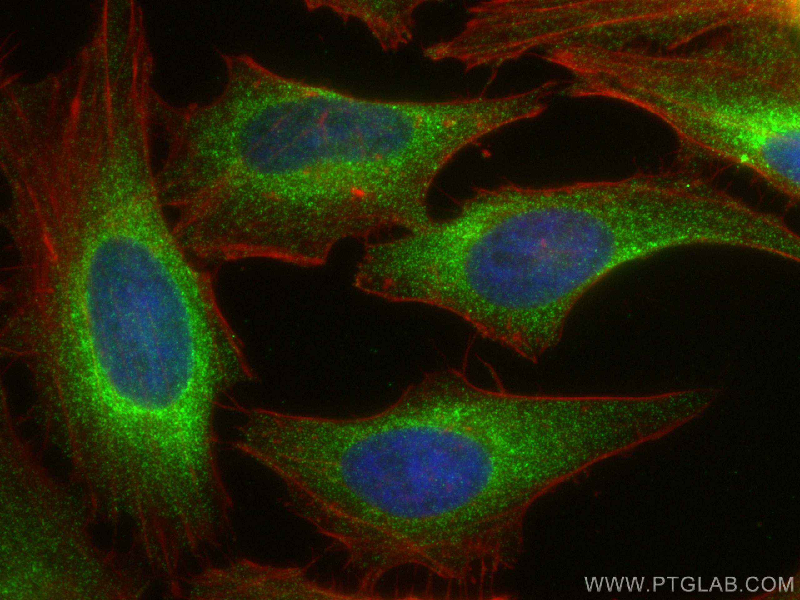Immunofluorescence (IF) / fluorescent staining of HeLa cells using SNX27 Monoclonal antibody (68386-1-Ig)