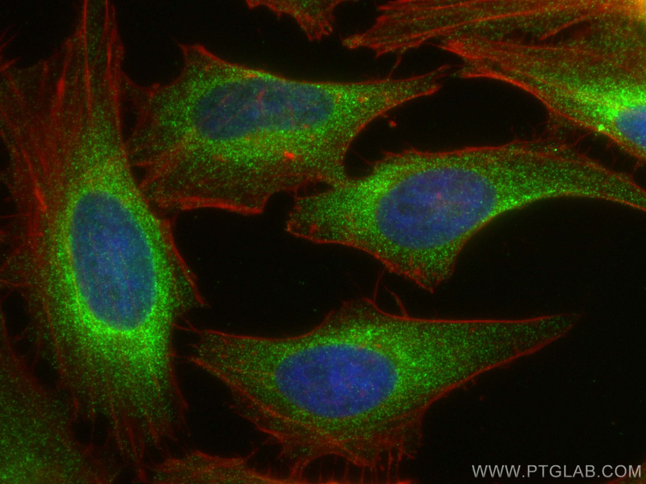 IF Staining of HeLa using 68386-1-Ig