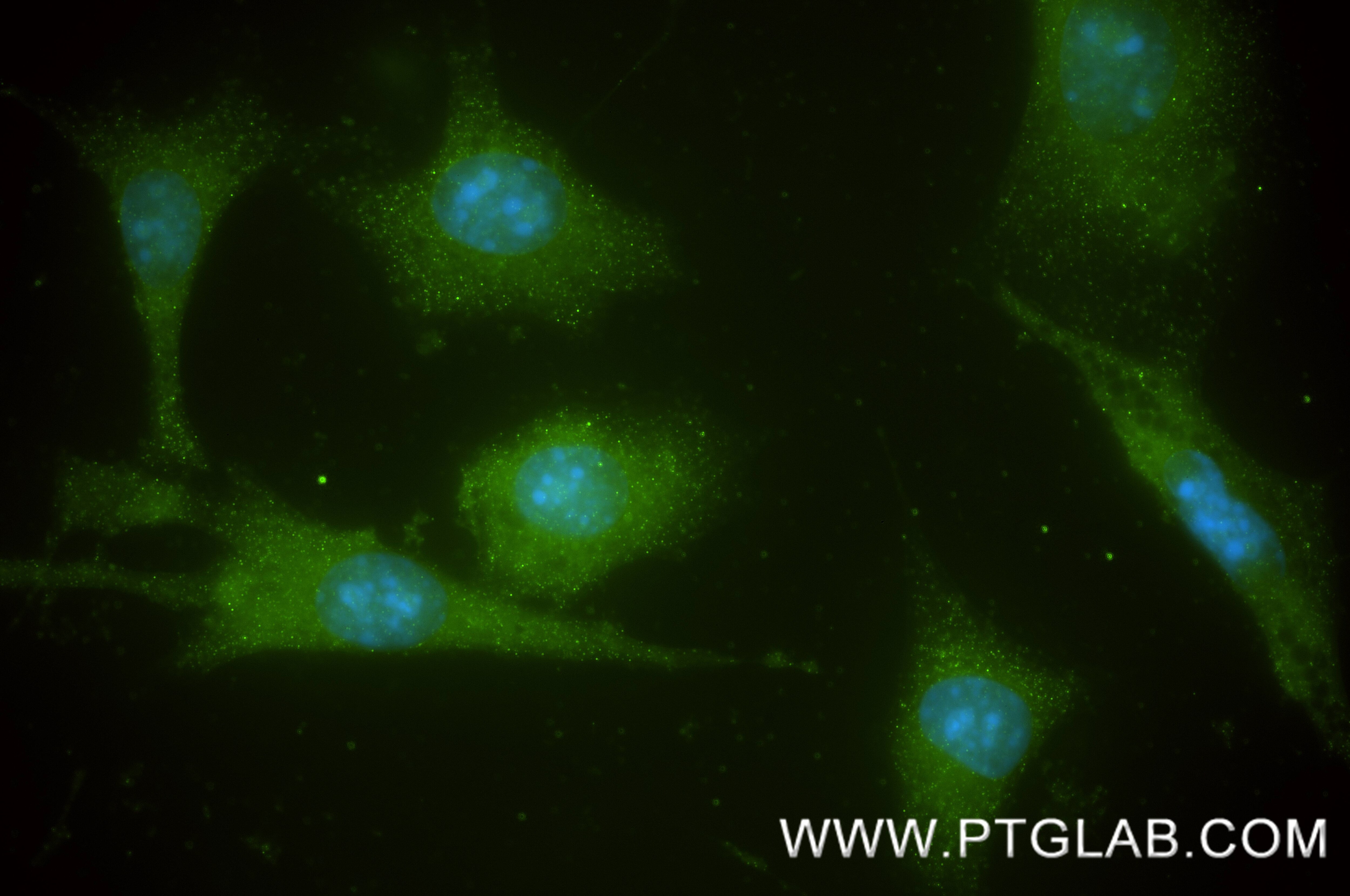 IF Staining of NIH/3T3 using 87039-1-RR Immunofluorescence (IF) / fluorescent staining of NIH/3T3 cells using SNX27 Recombinant monoclonal antibody (87039-1-RR)