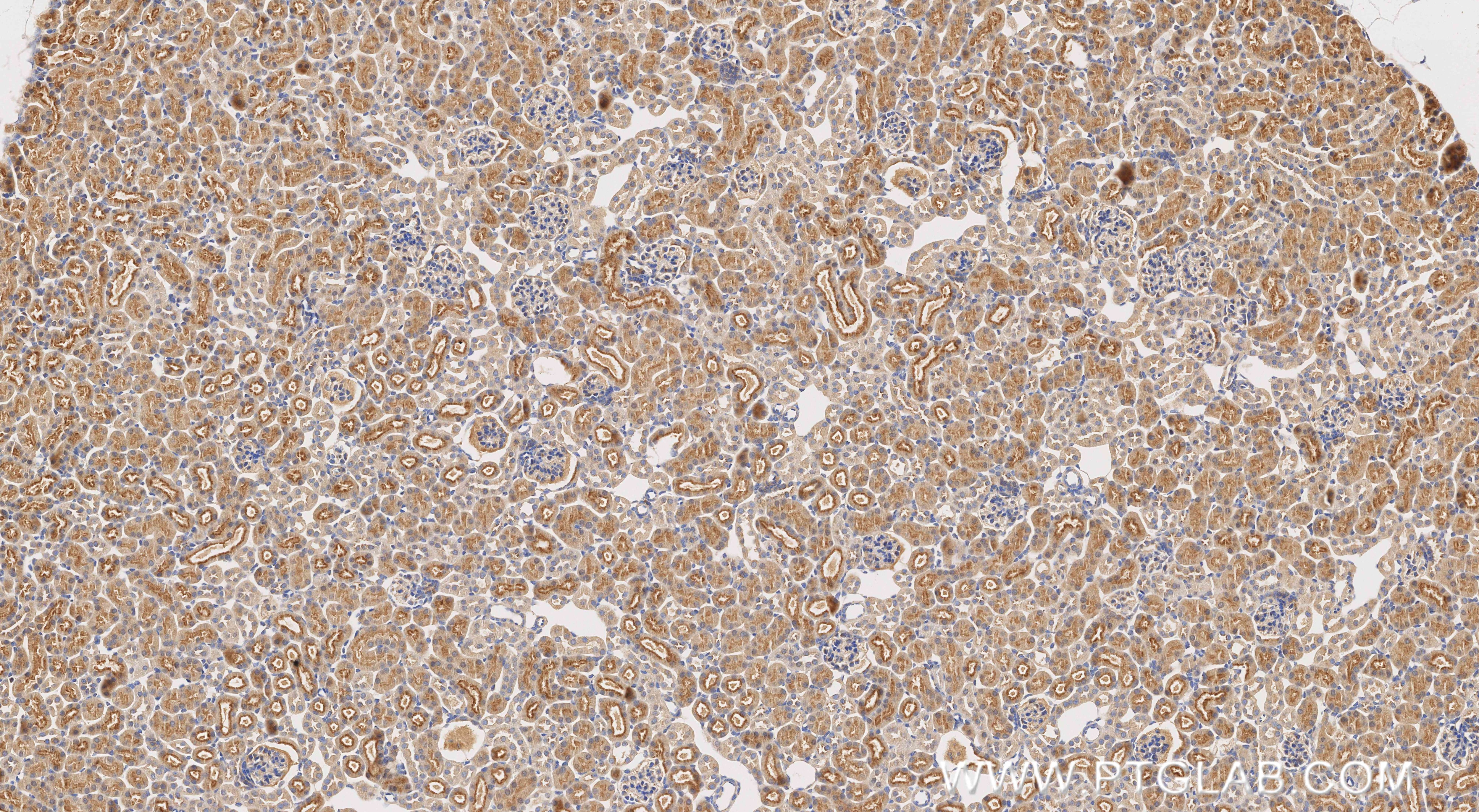 Immunohistochemistry (IHC) staining of mouse kidney tissue using SNX27 Recombinant monoclonal antibody (87039-1-RR)