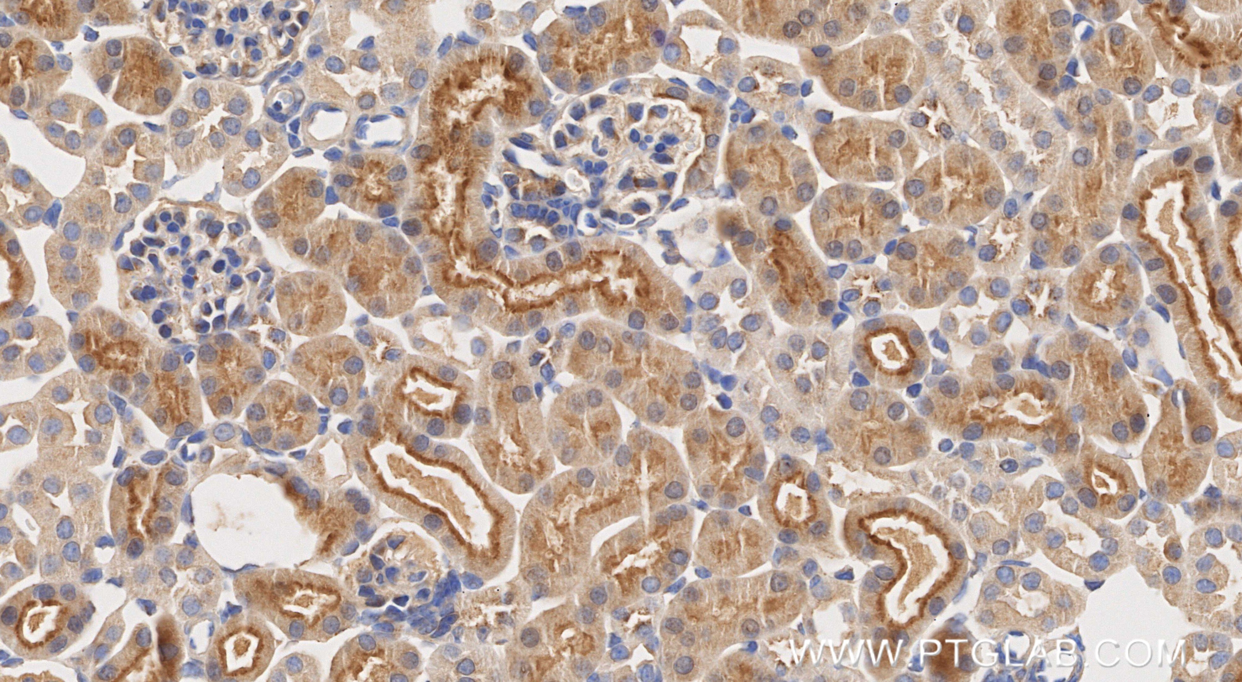 Immunohistochemistry (IHC) staining of mouse kidney tissue using SNX27 Recombinant monoclonal antibody (87039-1-RR)