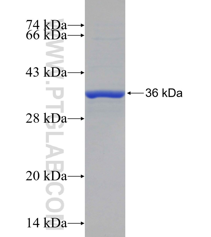 SNX27 fusion protein Ag29226 SDS-PAGE SNX27 fusion protein Ag29226 SDS-PAGE