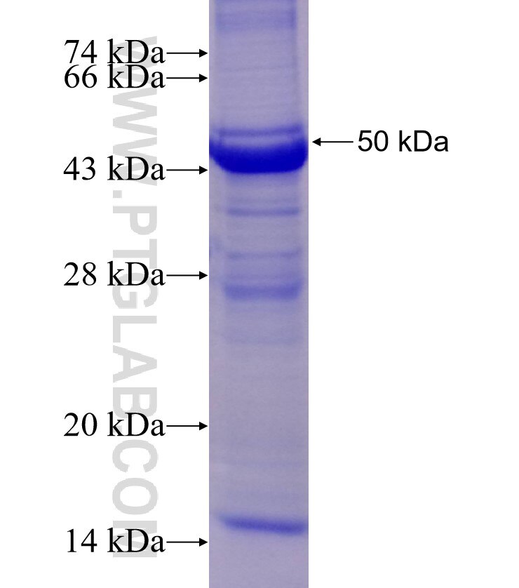 SNX27 fusion protein Ag9447 SDS-PAGE