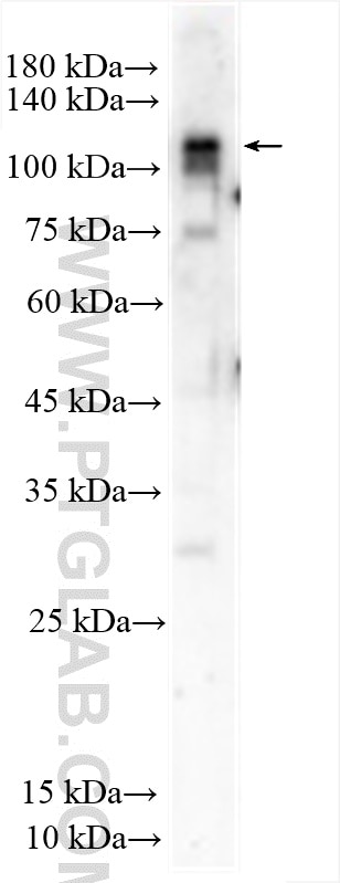 Western Blot (WB) analysis of HepG2 cells using SNX29 Polyclonal antibody (30512-1-AP)