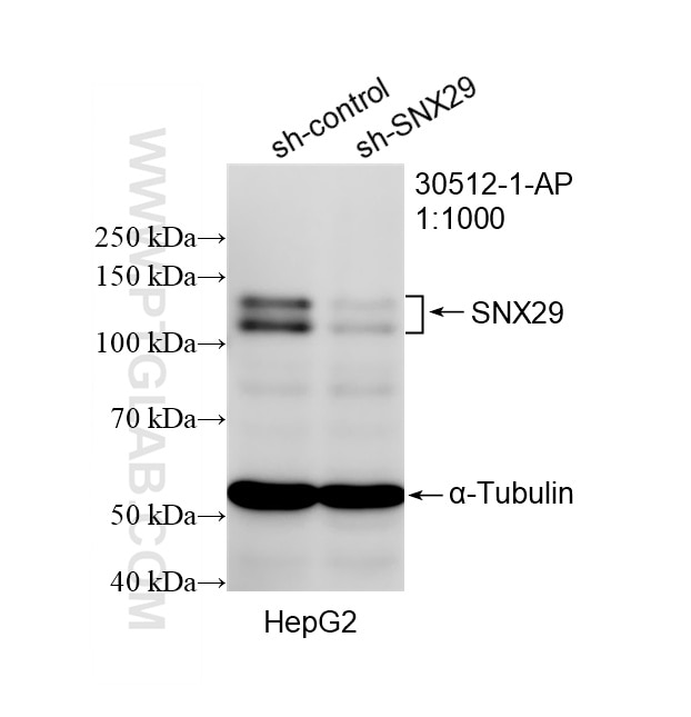 WB result of SNX29 antibody (30512-1-AP; 1:1000; incubated at room temperature for 1.5 hours) with sh-Control and sh-SNX29 transfected HepG2 cells. Western Blot (WB) analysis of HepG2 cells using SNX29 Polyclonal antibody (30512-1-AP)