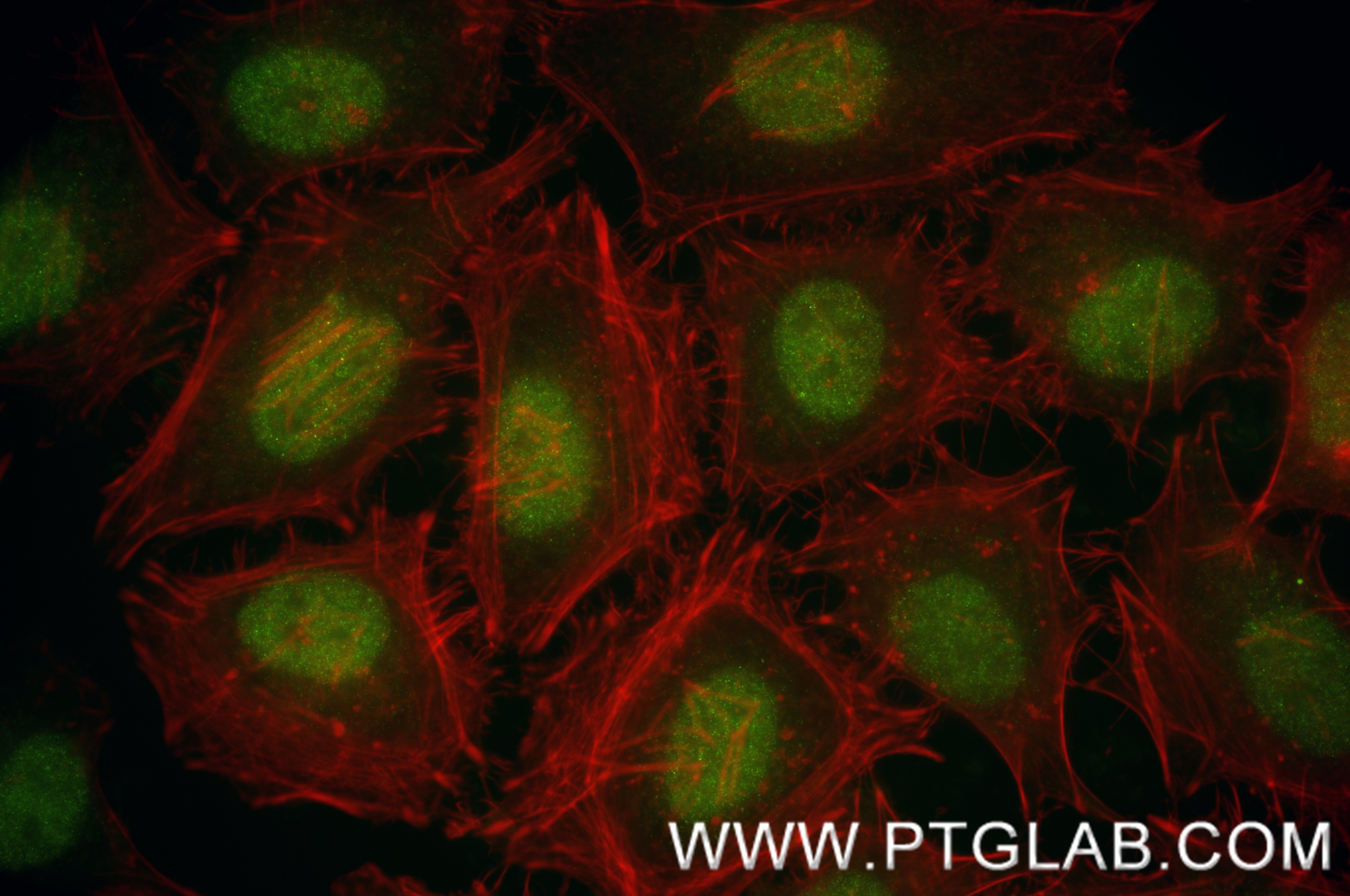 Immunofluorescence (IF) / fluorescent staining of HeLa cells using SNX29 Recombinant monoclonal antibody (86446-1-RR)