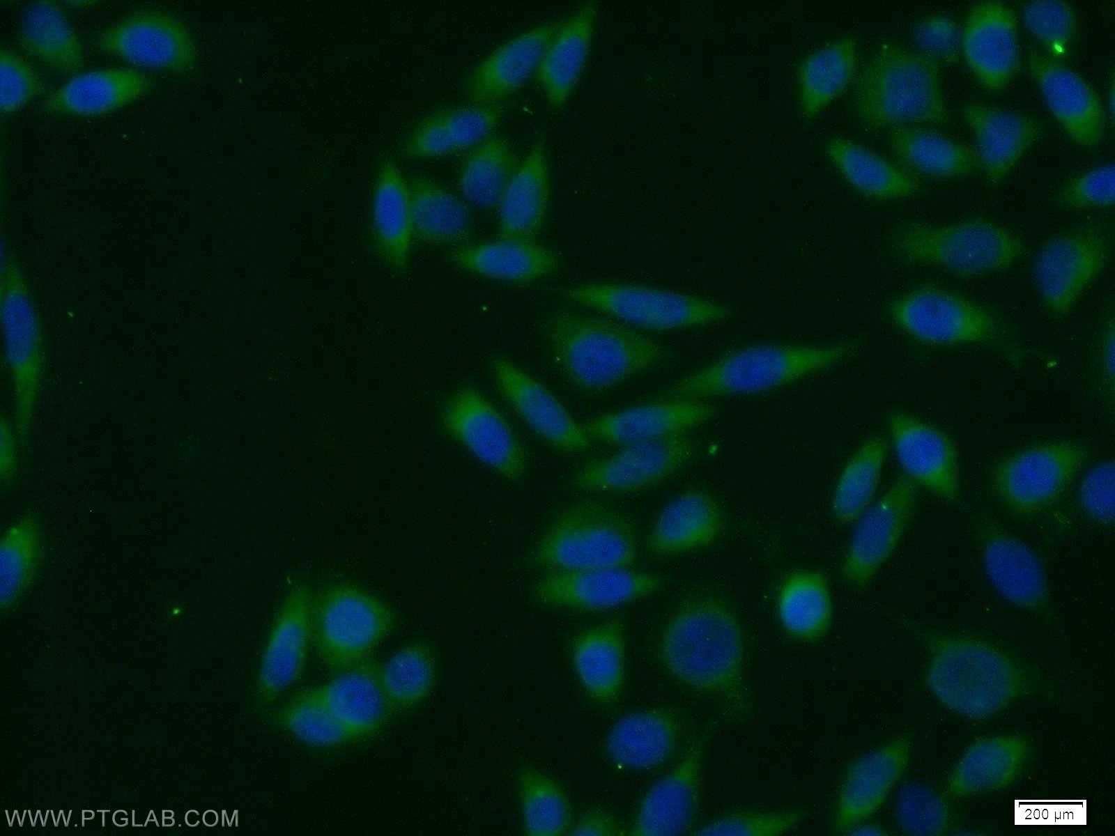 Immunofluorescence (IF) / fluorescent staining of HeLa cells using SNX3 Polyclonal antibody (10772-1-AP)