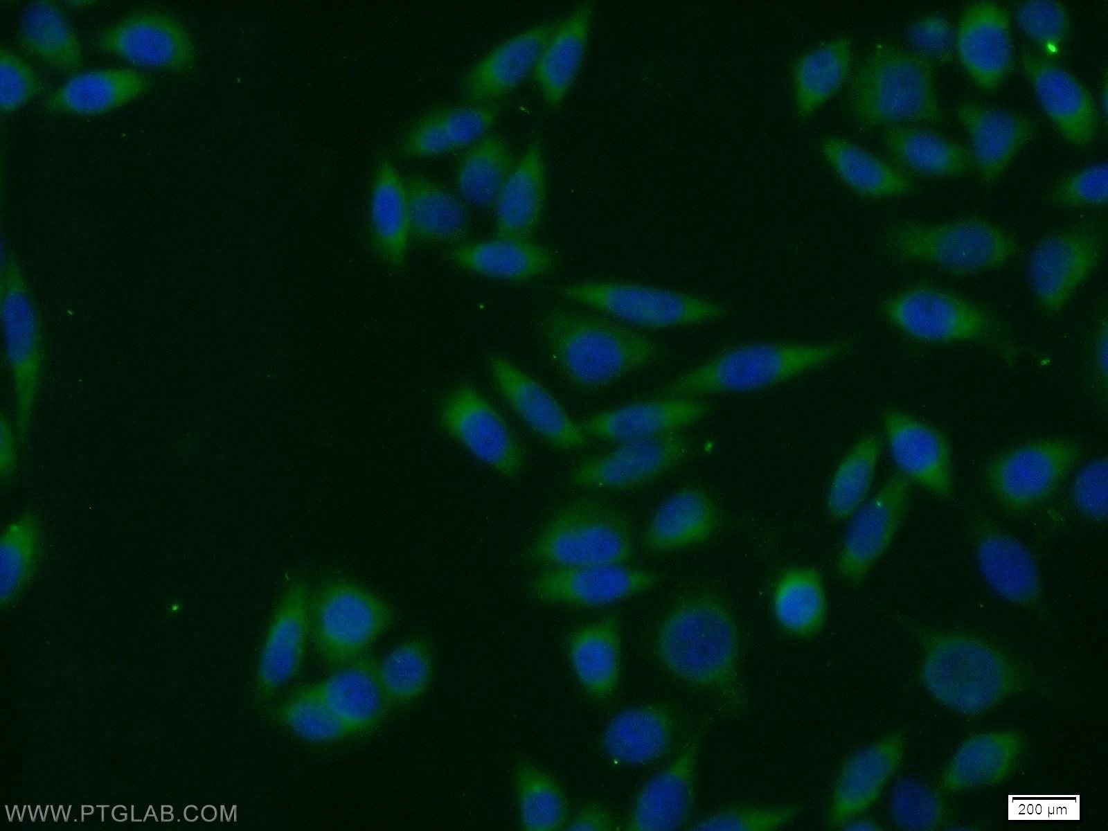 IF Staining of HeLa using 10772-1-AP