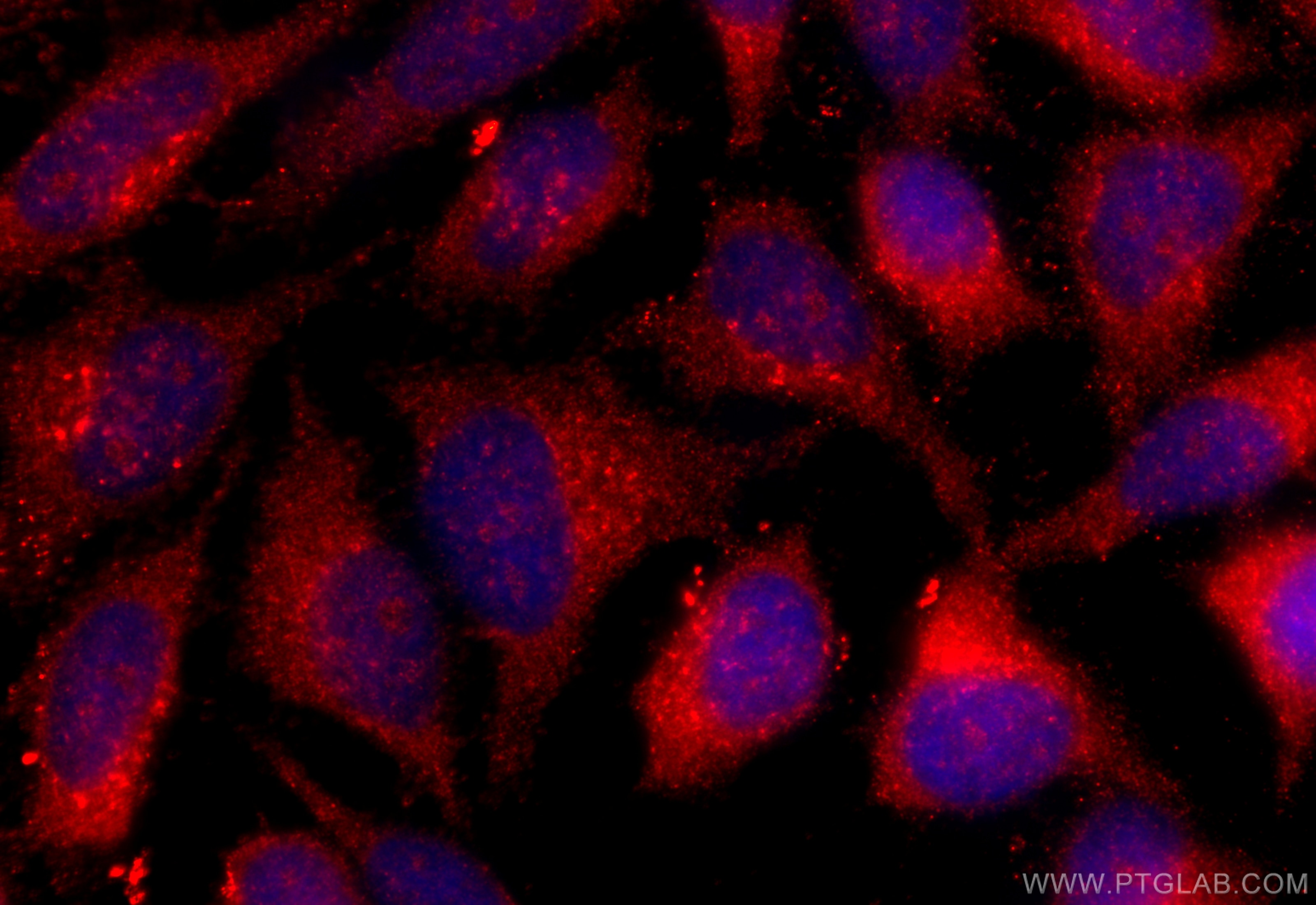 Immunofluorescence (IF) / fluorescent staining of HeLa cells using SNX3 Polyclonal antibody (10772-1-AP)