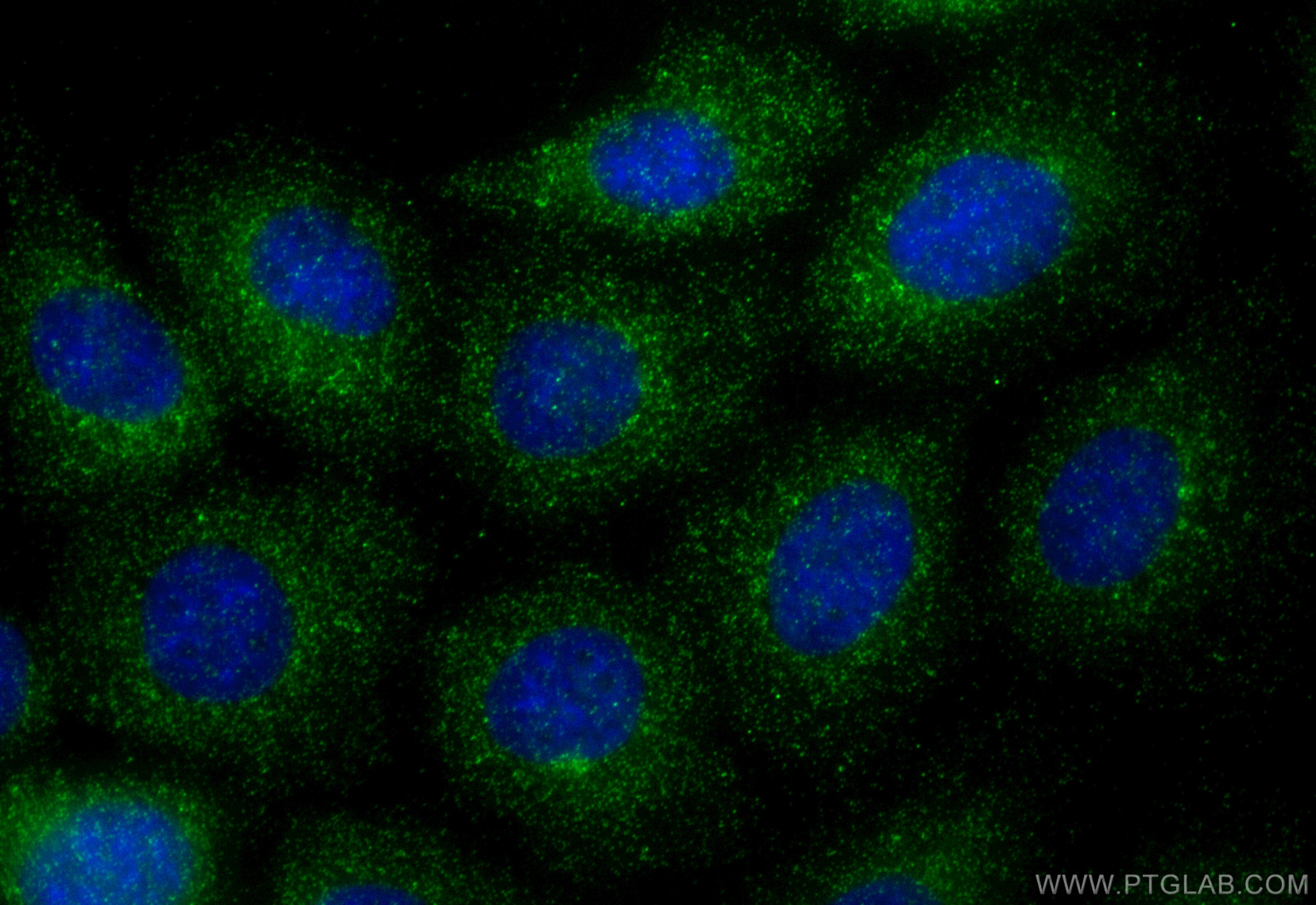 Immunofluorescence (IF) / fluorescent staining of A431 cells using SNX3 Polyclonal antibody (10772-1-AP)