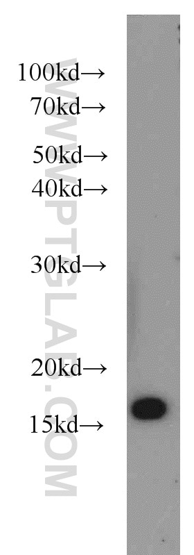 Western Blot (WB) analysis of A549 cells using SNX3 Polyclonal antibody (10772-1-AP)