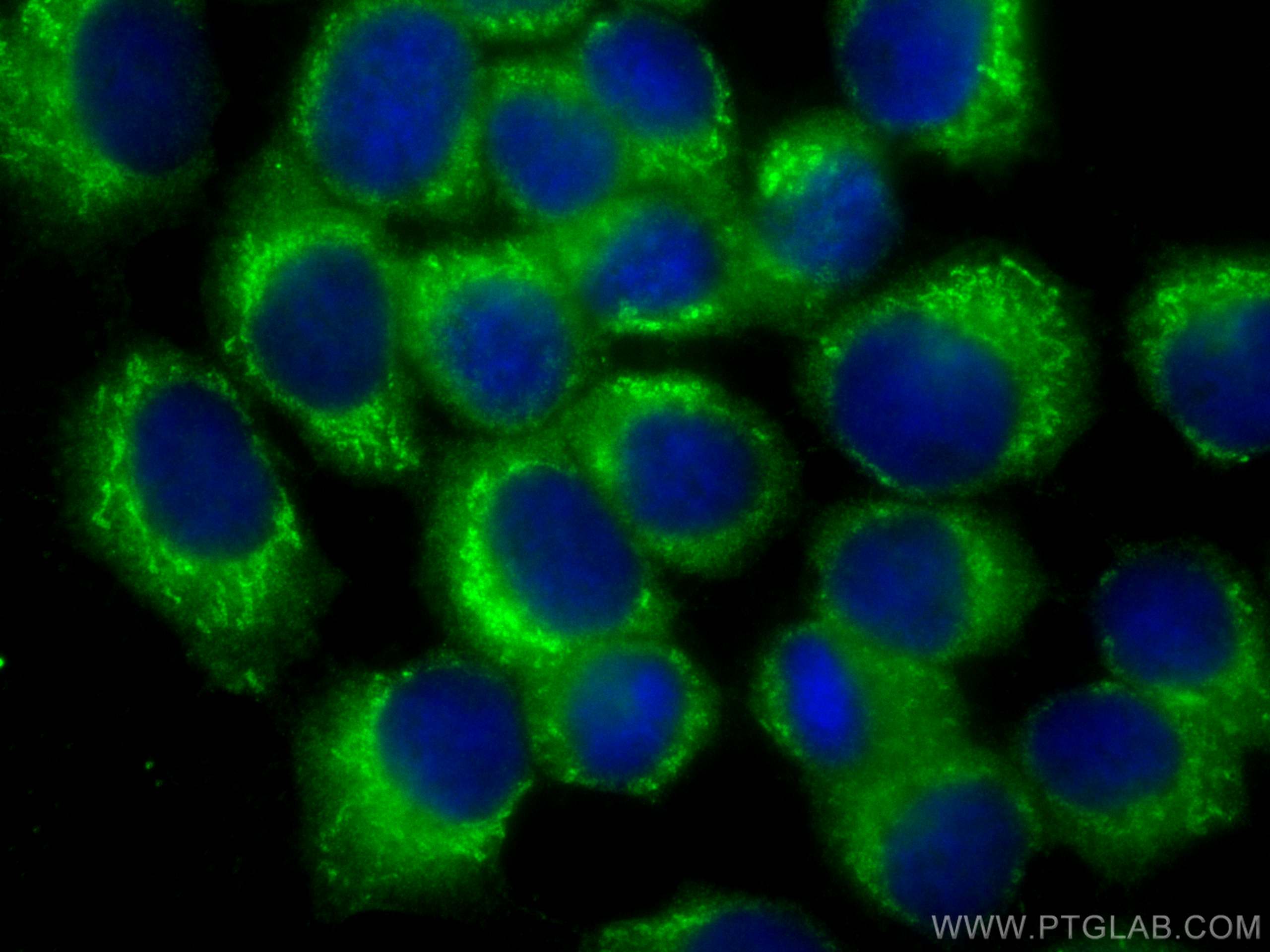 Immunofluorescence (IF) / fluorescent staining of A431 cells using SNX3 Monoclonal antibody (68292-1-Ig)