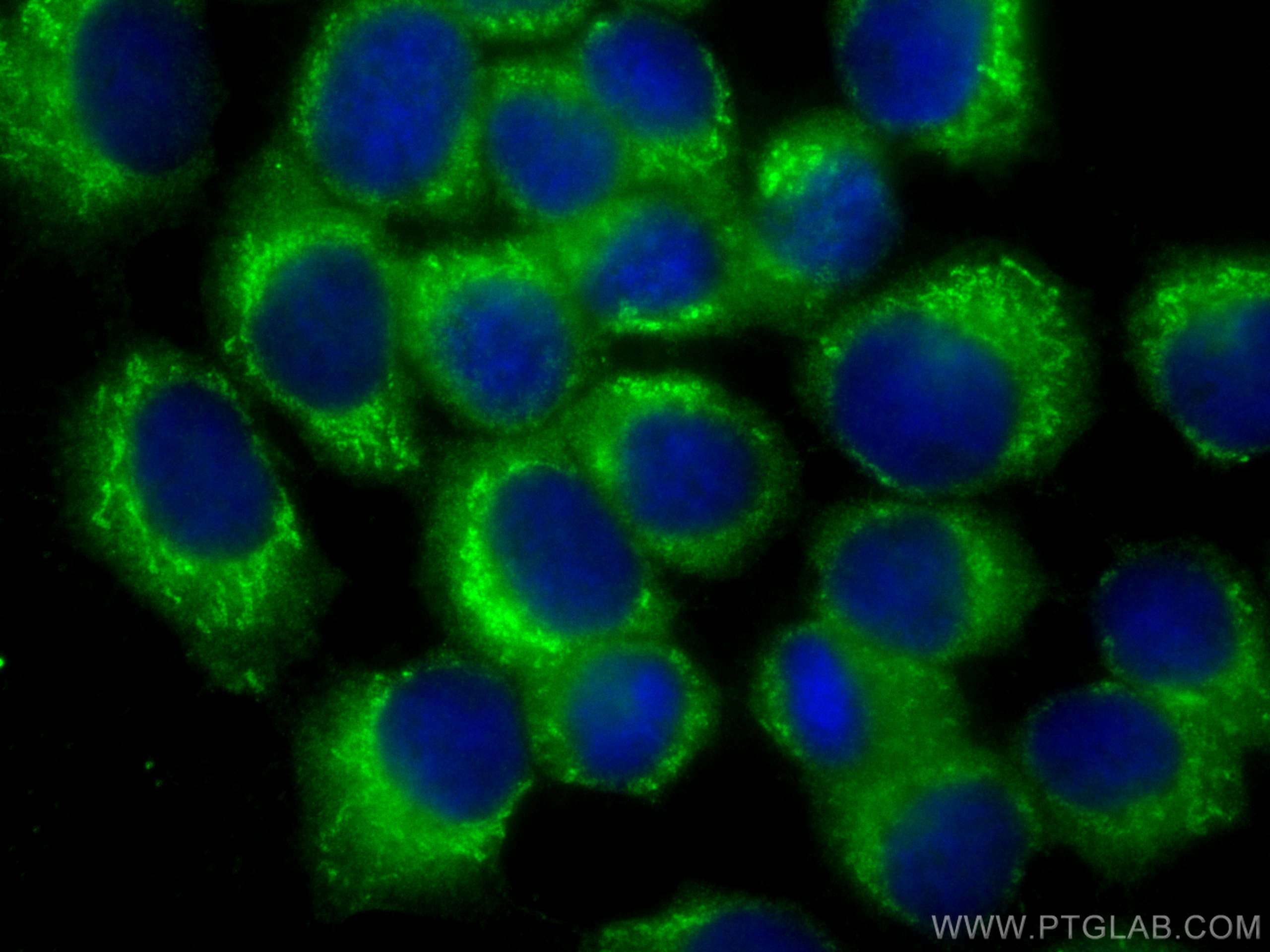 Immunofluorescence (IF) / fluorescent staining of A431 cells using SNX3 Monoclonal antibody (68292-1-Ig)