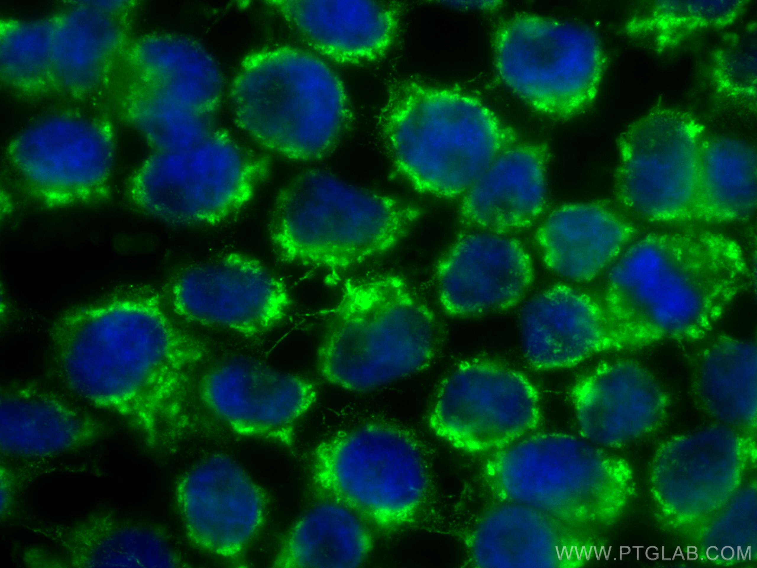 Immunofluorescence (IF) / fluorescent staining of A431 cells using CoraLite® Plus 488-conjugated SNX3 Monoclonal anti (CL488-68292)