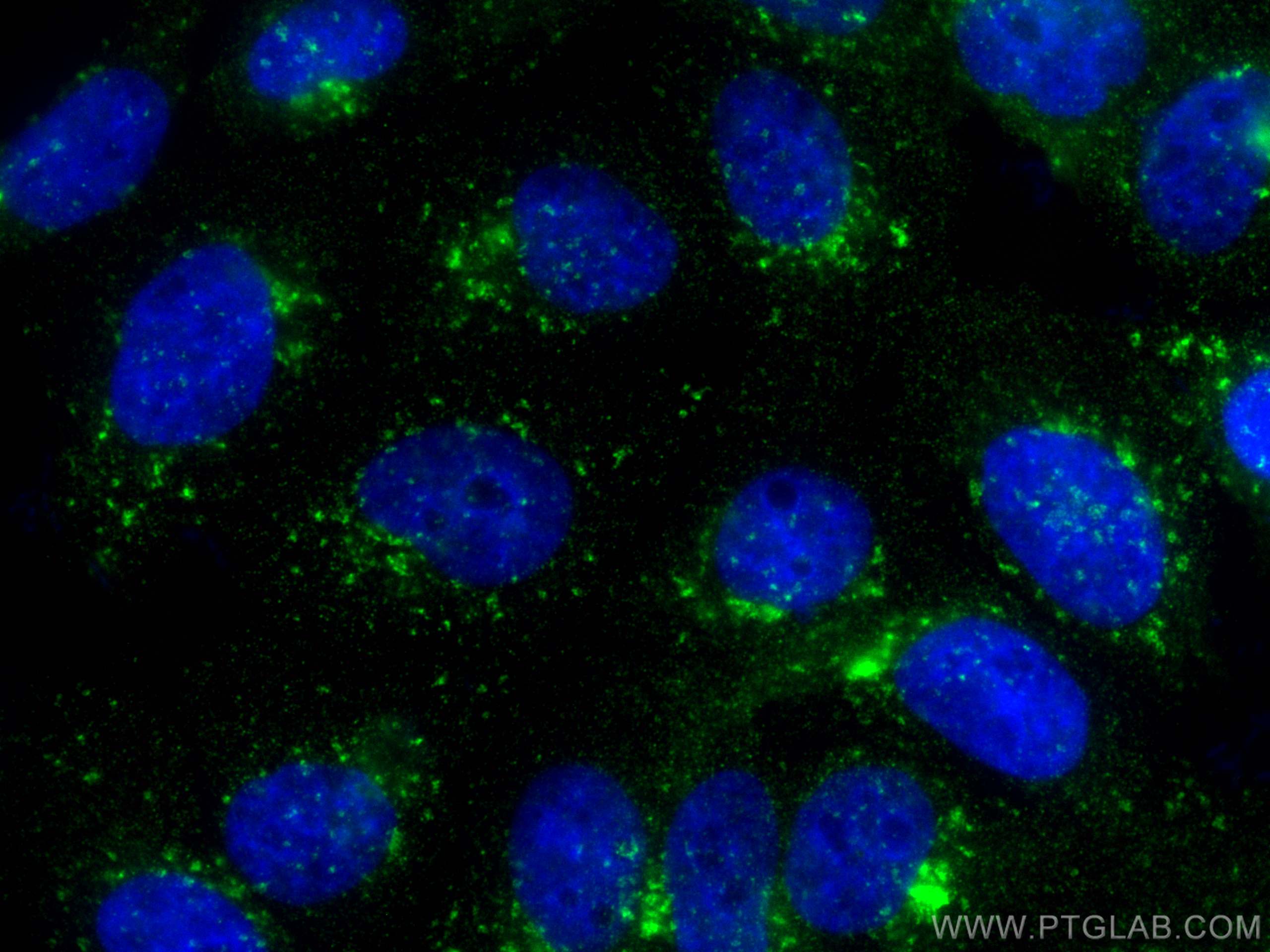 Immunofluorescence (IF) / fluorescent staining of A431 cells using CoraLite® Plus 488-conjugated SNX3 Monoclonal anti (CL488-68292)