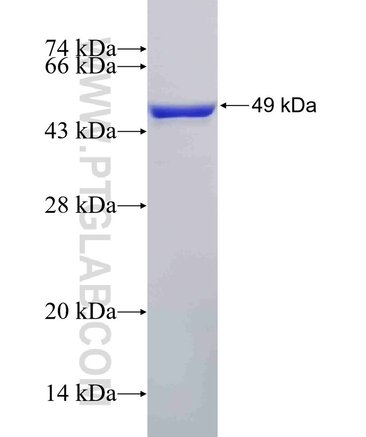SNX3 fusion protein Ag1160 SDS-PAGE