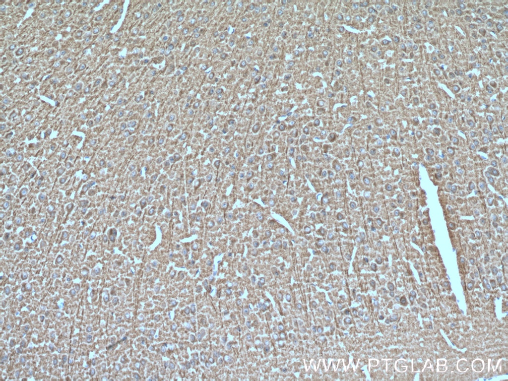 IHC staining of mouse brain using 25763-1-AP