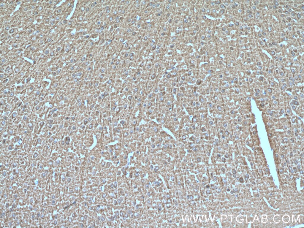 Immunohistochemistry (IHC) staining of mouse brain tissue using SNX32 Polyclonal antibody (25763-1-AP)