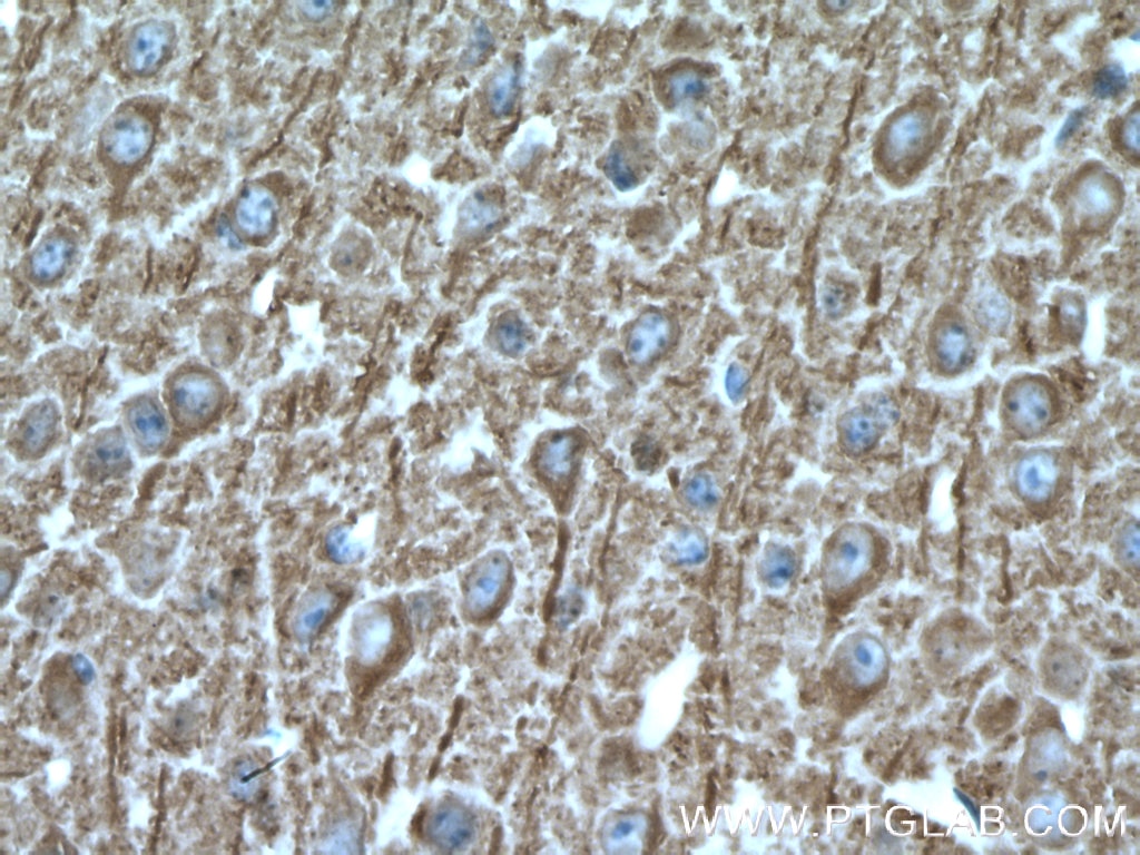 Immunohistochemistry (IHC) staining of mouse brain tissue using SNX32 Polyclonal antibody (25763-1-AP)