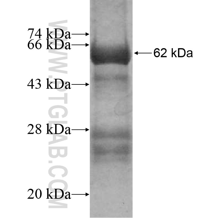 SNX33 fusion protein Ag9752 SDS-PAGE