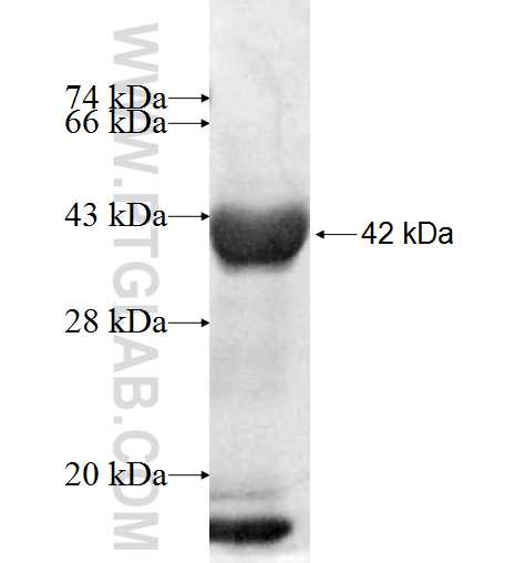 SNX33 fusion protein Ag9915 SDS-PAGE