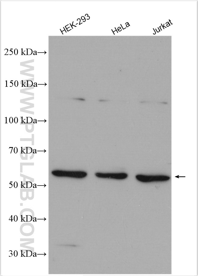 Western Blot (WB) analysis of various lysates using SNX4 Polyclonal antibody (11506-1-AP)