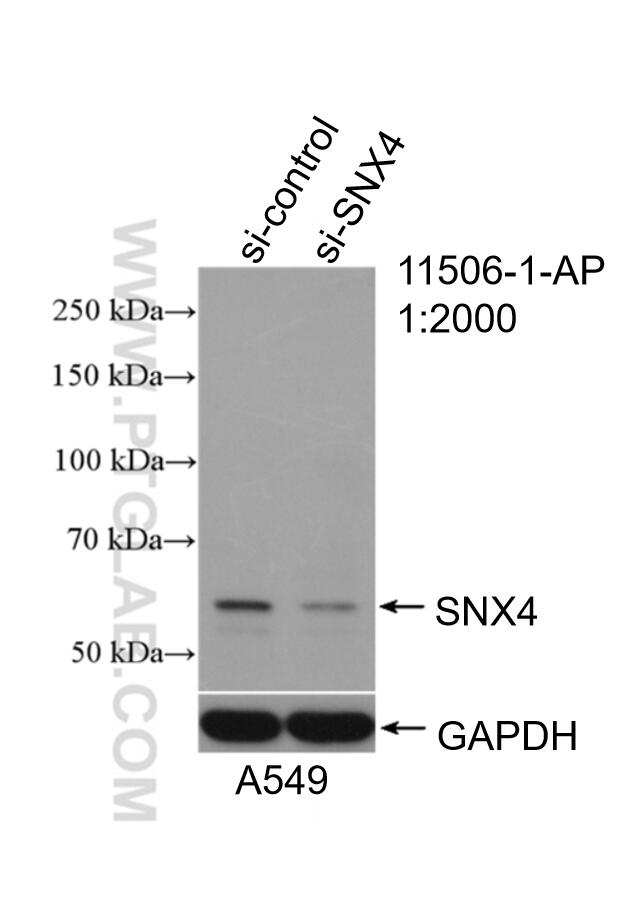 Western Blot (WB) analysis of A549 cells using SNX4 Polyclonal antibody (11506-1-AP)