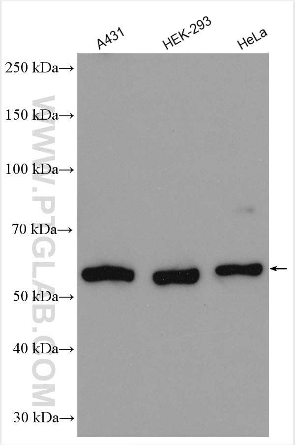 Western Blot (WB) analysis of various lysates using SNX4 Polyclonal antibody (11506-1-AP)