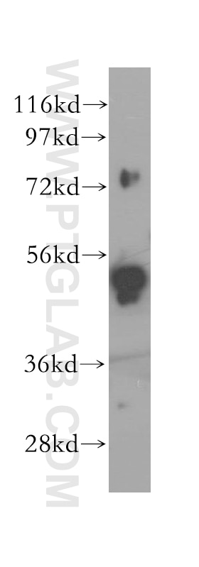 Western Blot (WB) analysis of NIH/3T3 cells using SNX4 Polyclonal antibody (11506-1-AP)