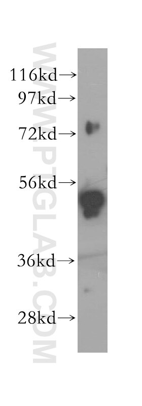 Western Blot (WB) analysis of NIH/3T3 cells using SNX4 Polyclonal antibody (11506-1-AP)