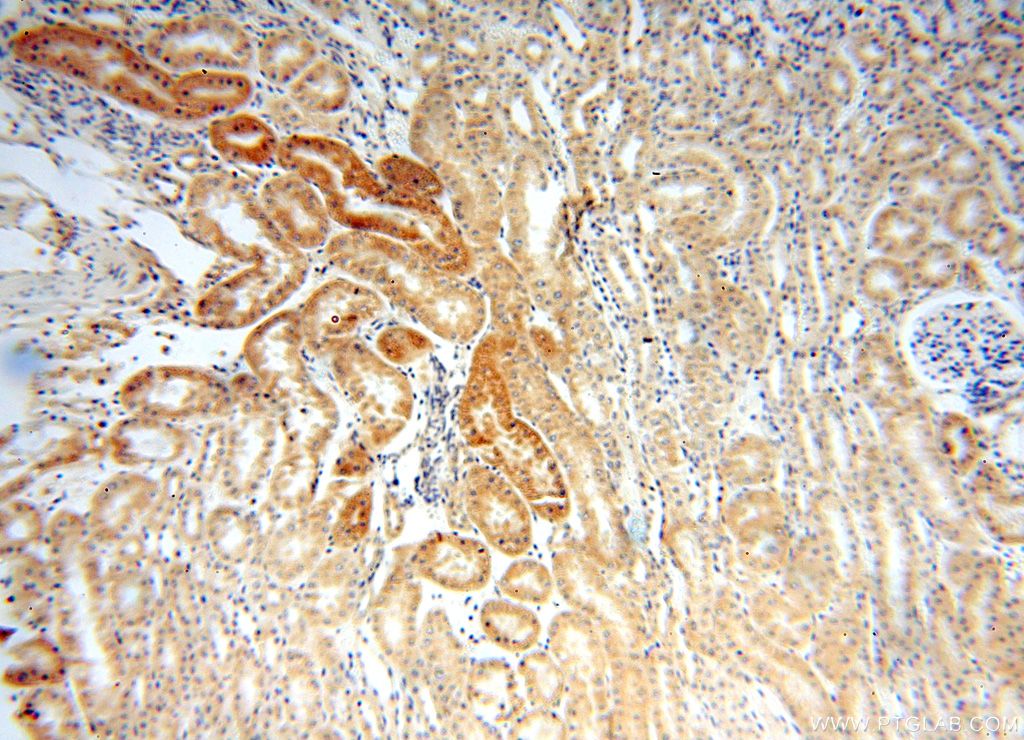 Immunohistochemistry (IHC) staining of human kidney tissue using SNX5 Polyclonal antibody (17918-1-AP)