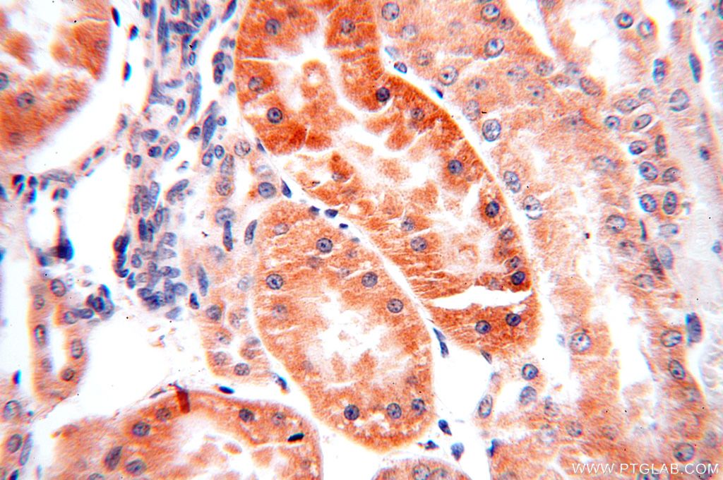 Immunohistochemistry (IHC) staining of human kidney tissue using SNX5 Polyclonal antibody (17918-1-AP)