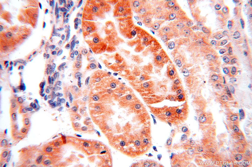 IHC staining of human kidney using 17918-1-AP