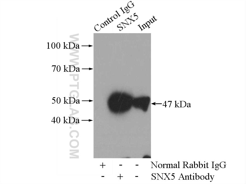 Immunoprecipitation (IP) experiment of mouse kidney tissue using SNX5 Polyclonal antibody (17918-1-AP)