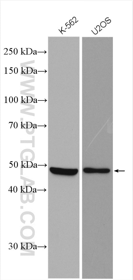 Western Blot (WB) analysis of various lysates using SNX5 Polyclonal antibody (17918-1-AP)