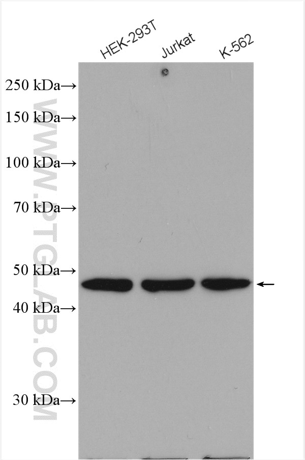 Western Blot (WB) analysis of various lysates using SNX5 Polyclonal antibody (17918-1-AP)